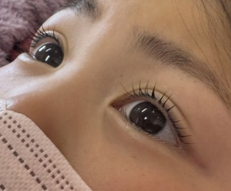 ビフォー&アフター