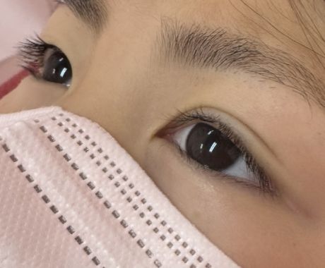 ビフォー&アフター
